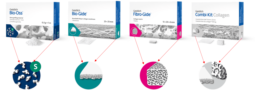 Productieverpakkingen nieuw design