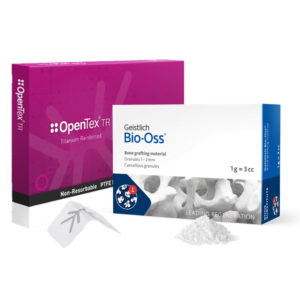 Grote botaugmentatie producten