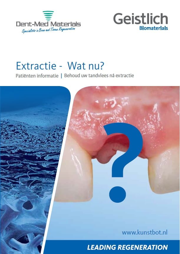 Extractie wat nu