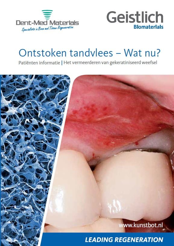 Ontstoken tandvlees