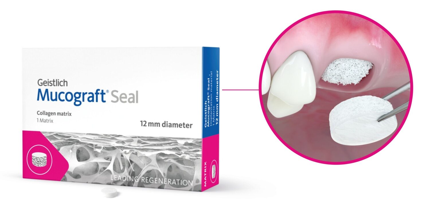 NEW Geistlich Mucograft Seal 12mm