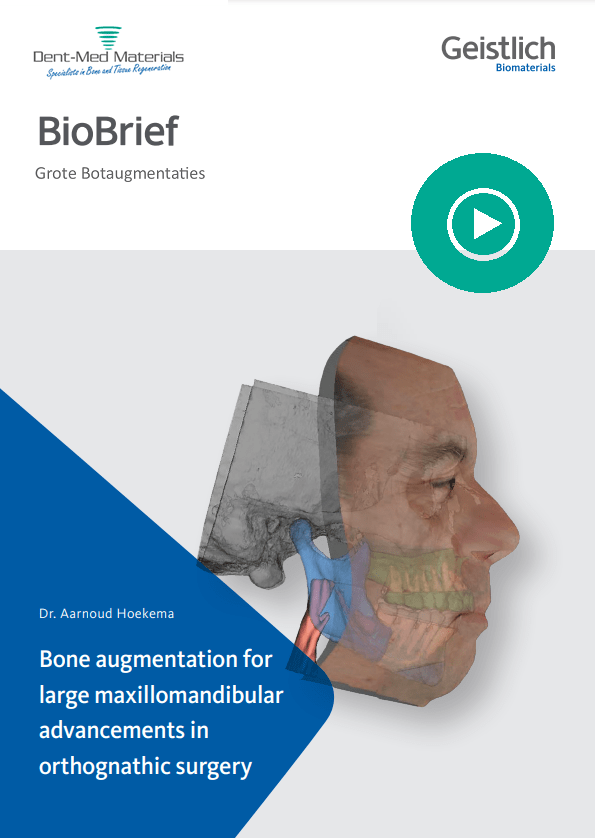 DMM-BioBrief Dr. Arnoud Hoekema- Grote Botaugmentaties