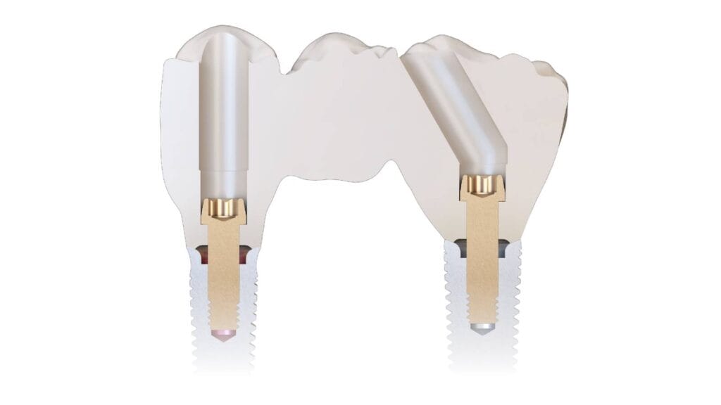 new_image_angled_channel_30_